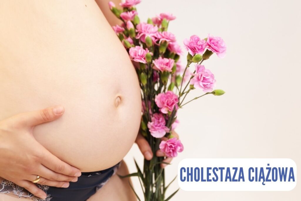 Cholestaza ciążowa