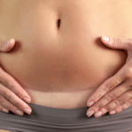 Jak przygotować się do cesarskiego cięcia